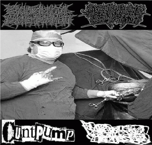 Agonizing Excess Bowel Acid Dissolving The Intestines Causing Massive Organ Trauma : 4 Ways Splits